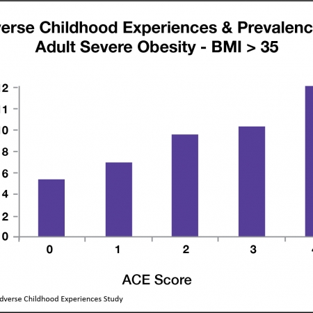 Let’s talk about… the stigma that people living with obesity face: Mary’s Story